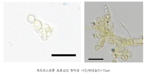 트리코스포론 포로섬 현미경 사진